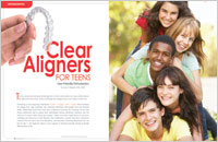 clear aligners for teens