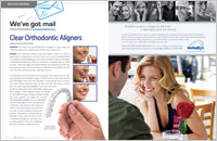 invisalign