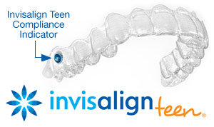 Invisalign Teen tray showing the compliance indicator.